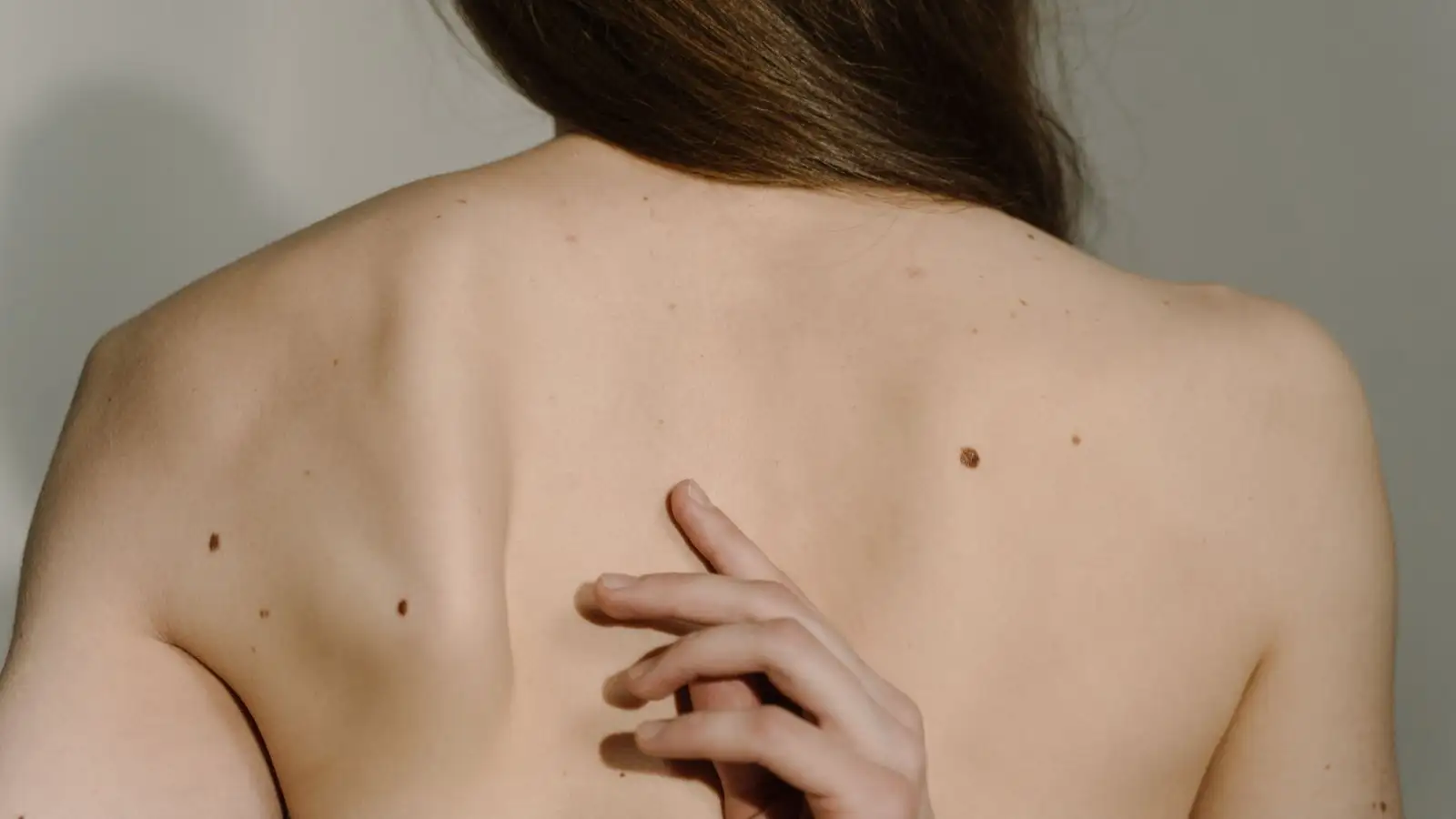 Grain de beauté : les signes qui doivent alerter